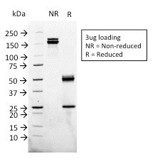 Glypican-3 (GPC3) (Hepatocellular Carcinoma Marker) Antibody in SDS-PAGE (SDS-PAGE)