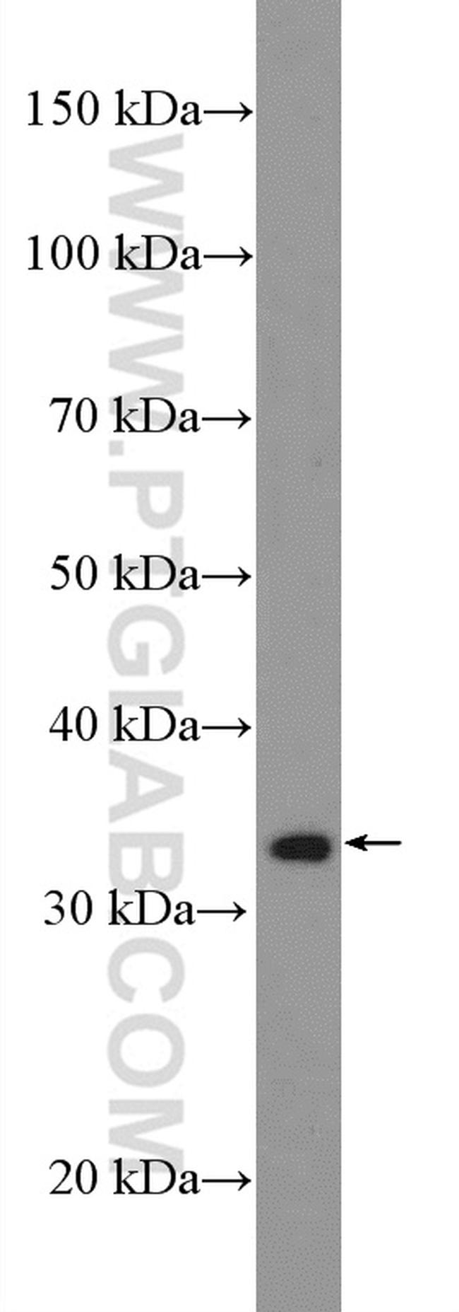 DUSP2 Antibody in Western Blot (WB)