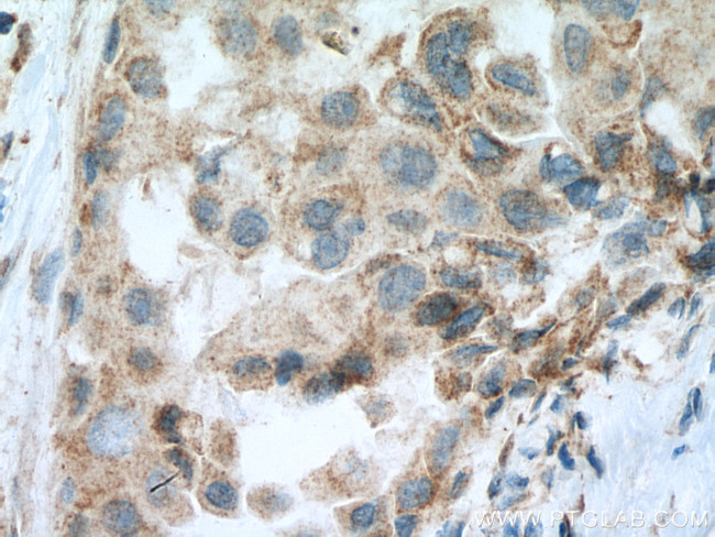 SEMA4A Antibody in Immunohistochemistry (Paraffin) (IHC (P))