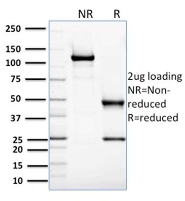 Glyoxalase 1 (GLO1) Antibody in SDS-PAGE (SDS-PAGE)