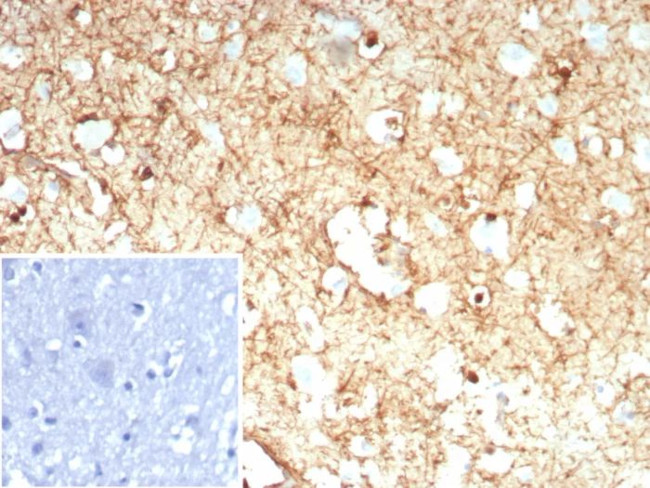 Glutamine Synthetase/GLUL Antibody in Immunohistochemistry (Paraffin) (IHC (P))