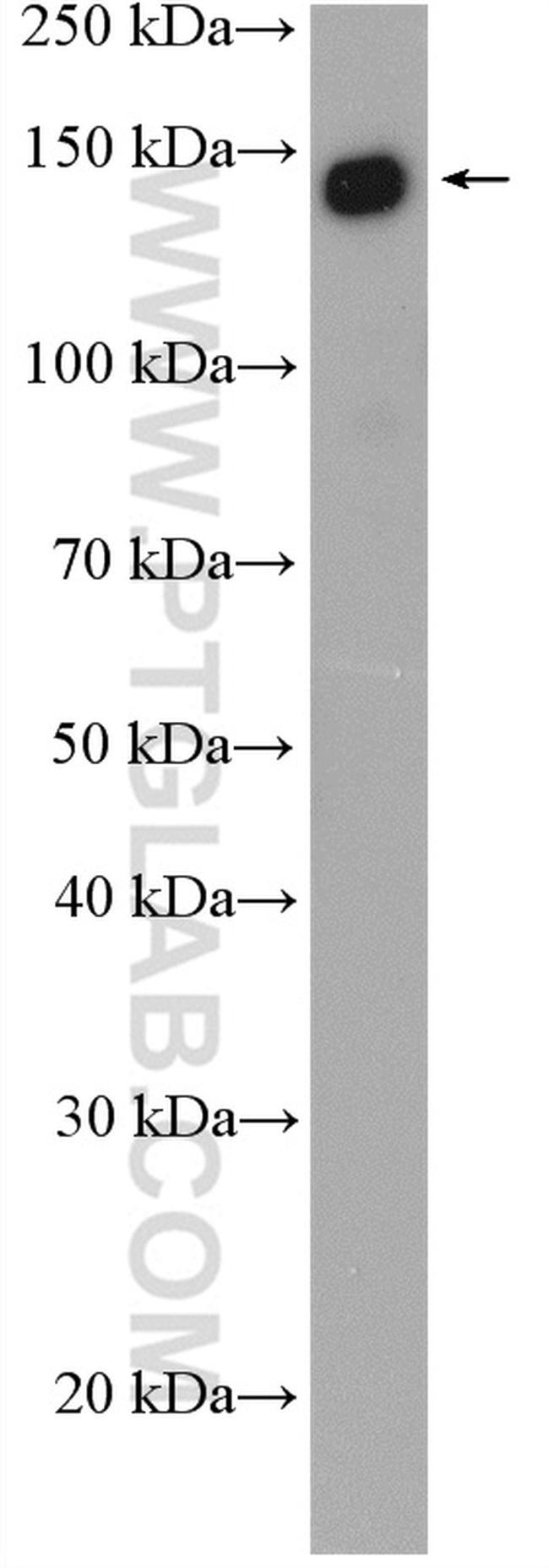 SF3B1 Antibody in Western Blot (WB)