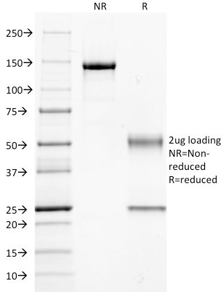 Guanine nucleotide-binding protein alpha-q/GNAQ/G-ALPHA-q Antibody in SDS-PAGE (SDS-PAGE)