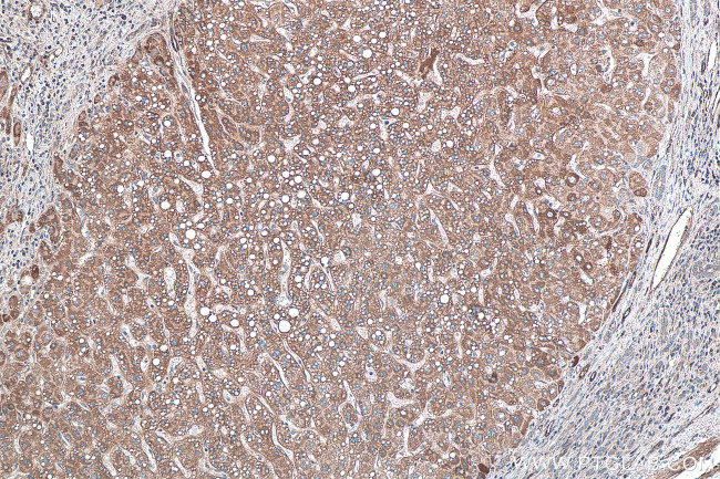 TNC/Tenascin-C Antibody in Immunohistochemistry (Paraffin) (IHC (P))