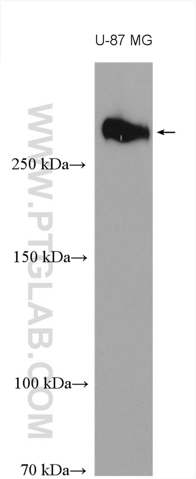 TNC/Tenascin-C Antibody in Western Blot (WB)