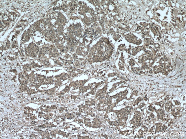 AKAP13 Antibody in Immunohistochemistry (Paraffin) (IHC (P))