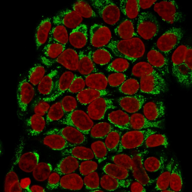 GnRH-Receptor/LH-RH Receptor Antibody in Immunocytochemistry (ICC/IF)