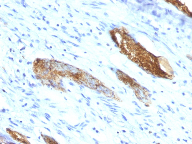 Blood Group Antigen A (CD173) Antibody in Immunohistochemistry (Paraffin) (IHC (P))