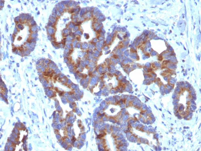 Blood Group Antigen A (CD173) Antibody in Immunohistochemistry (Paraffin) (IHC (P))