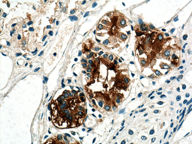 MUC5B Antibody in Immunohistochemistry (Paraffin) (IHC (P))