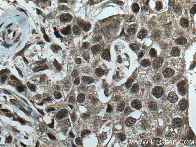 CUL1 Antibody in Immunohistochemistry (Paraffin) (IHC (P))