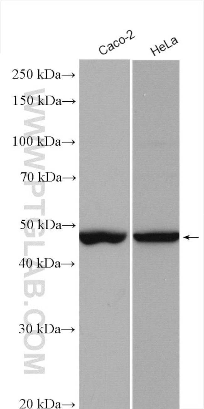 FOXJ1 Antibody in Western Blot (WB)