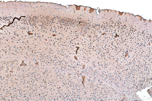 NMDAR2A/GRIN2A Antibody in Immunohistochemistry (Paraffin) (IHC (P))