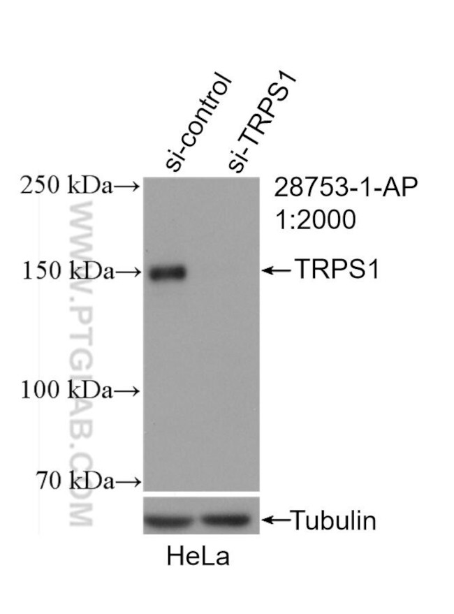 TRPS1 Antibody in Western Blot (WB)