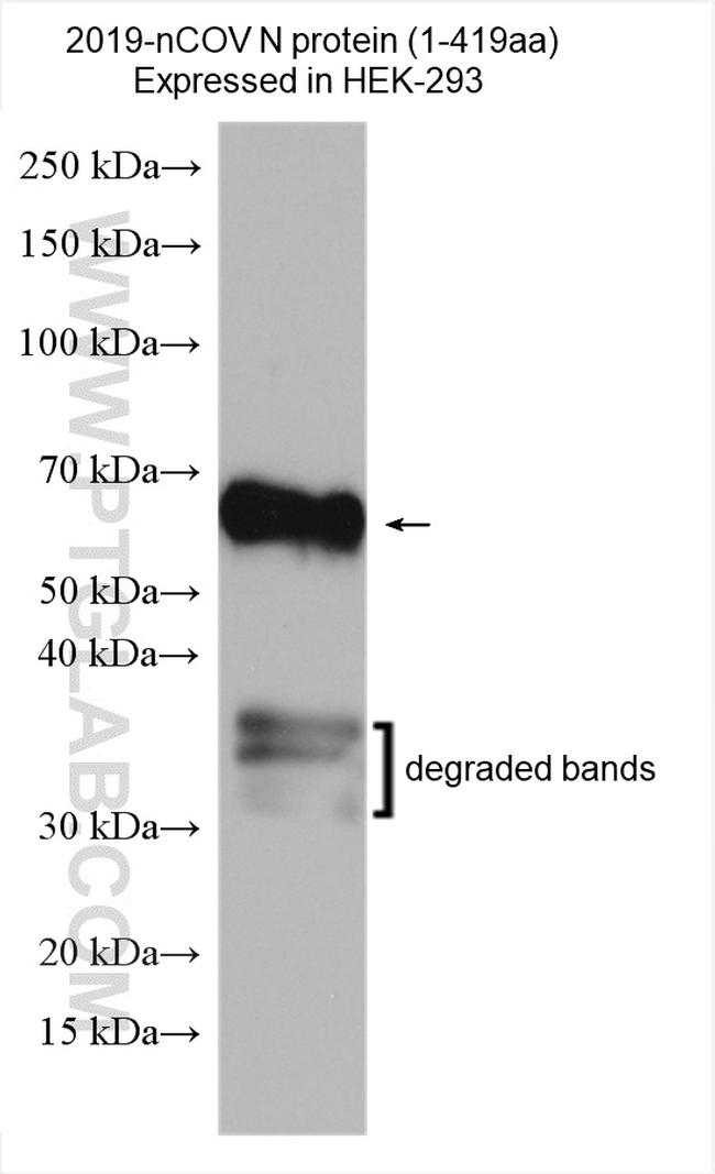 SARS-CoV-2 Nucleocapsid Phosphoprotein Antibody in Western Blot (WB)