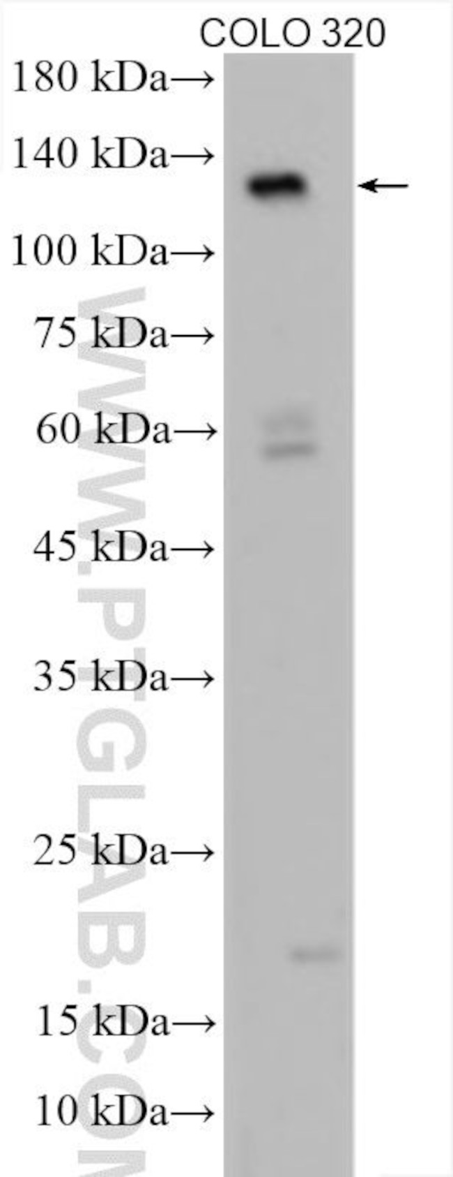 APAF1 Antibody in Western Blot (WB)