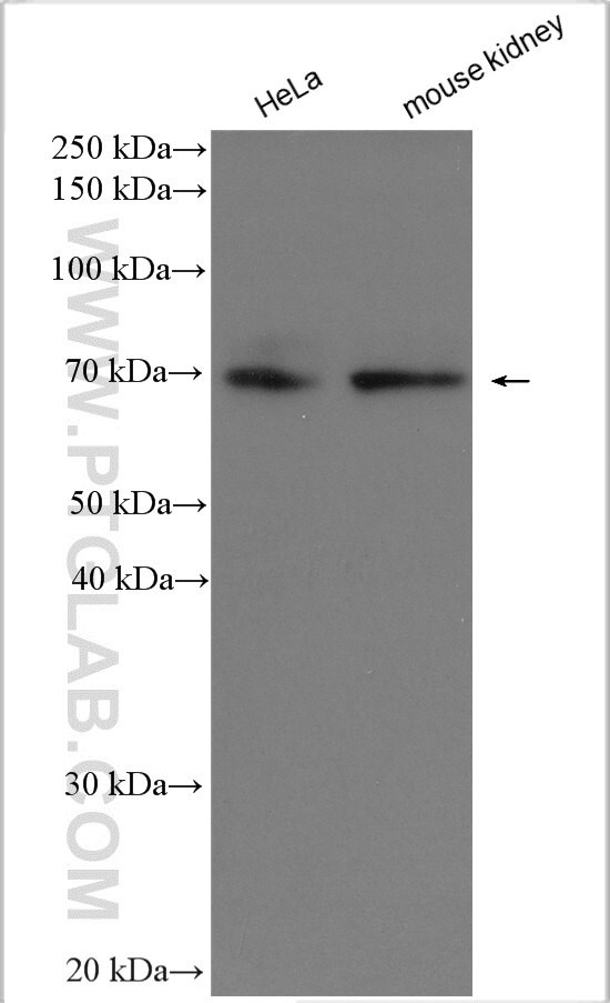 SLC6A19 Antibody in Western Blot (WB)