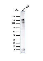 MSH6 (DNA Mismatch Repair Protein) Antibody in Western Blot (WB)