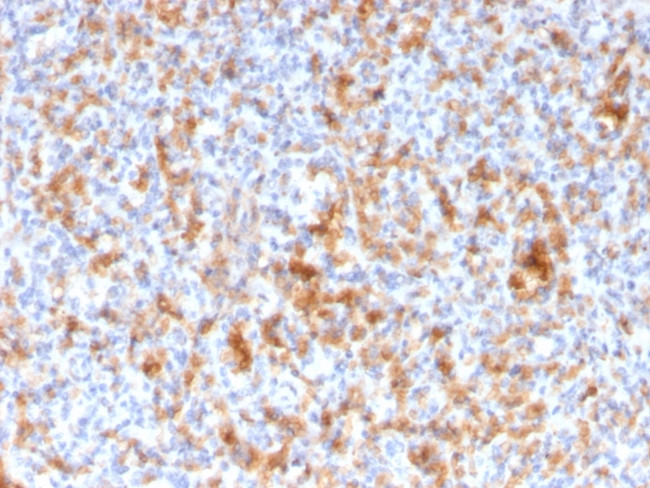 Granzyme B Monoclonal Antibody (GZMB, 3056) (3002-MSM6-P1)