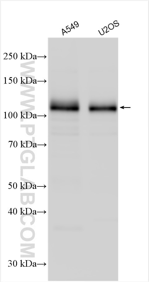 DCBLD2 Antibody in Western Blot (WB)