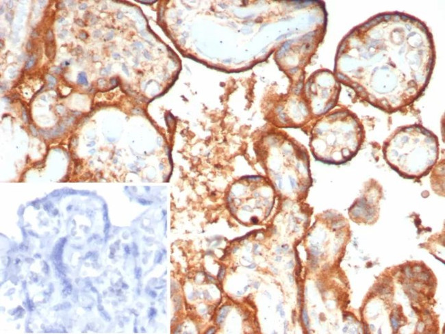 HEXB Antibody in Immunohistochemistry (Paraffin) (IHC (P))