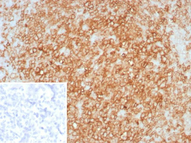 HLA-DR (MHC II) Antibody in Immunohistochemistry (Paraffin) (IHC (P))