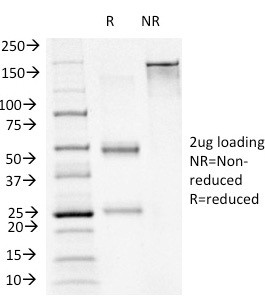 FOXA1/HNF3A Antibody in SDS-PAGE (SDS-PAGE)