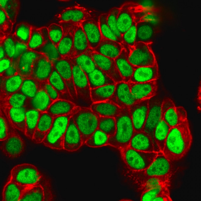 FOXA1/HNF3A Antibody in Immunocytochemistry (ICC/IF)