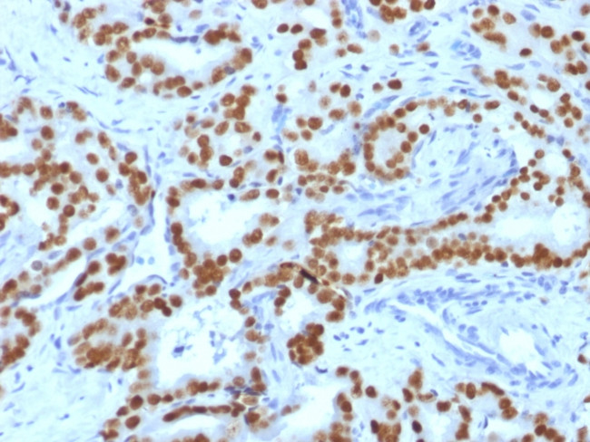 FOXA1/HNF3A Antibody in Immunohistochemistry (Paraffin) (IHC (P))