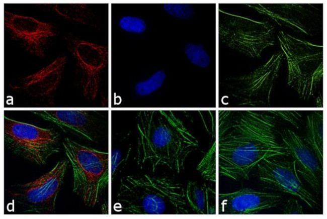 Rabbit IgG (H+L) Cross-Adsorbed Secondary Antibody in Immunocytochemistry (ICC/IF)