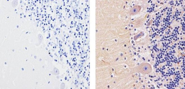 GluR2 Antibody in Immunohistochemistry (Paraffin) (IHC (P))