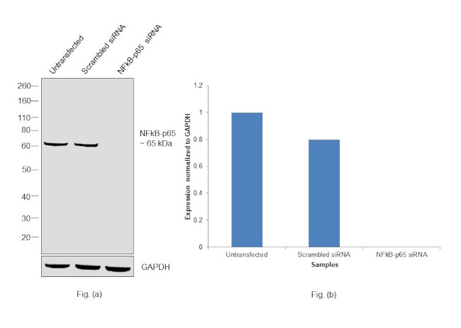 NFkB p65 Antibody