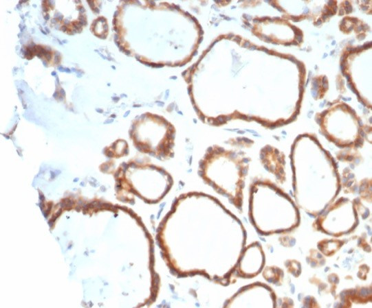 HSP90AB1 (Heat Shock Protein 90) Antibody in Immunohistochemistry (Paraffin) (IHC (P))