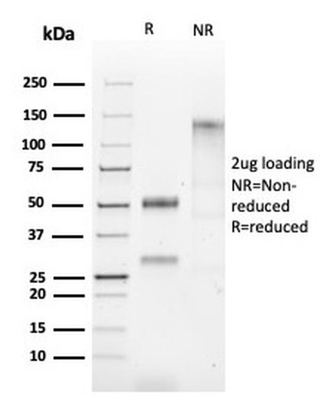 HSP60 (Heat Shock Protein 60) Antibody in SDS-PAGE (SDS-PAGE)