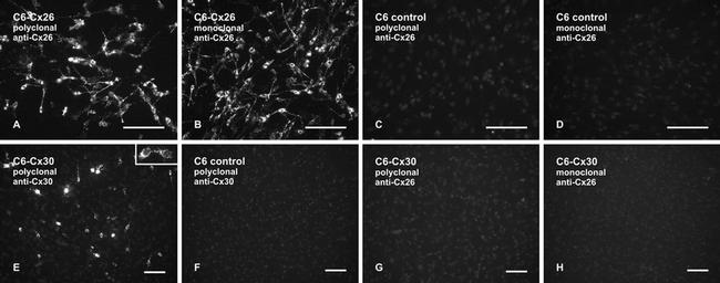 Connexin 26 Antibody in Immunocytochemistry (ICC/IF)