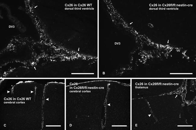 Connexin 26 Antibody in Immunohistochemistry (IHC)