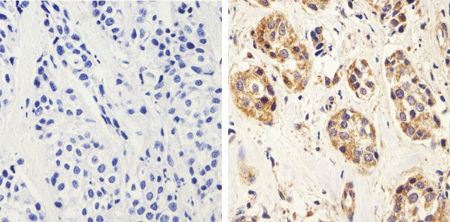 Bax Antibody in Immunohistochemistry (Paraffin) (IHC (P))