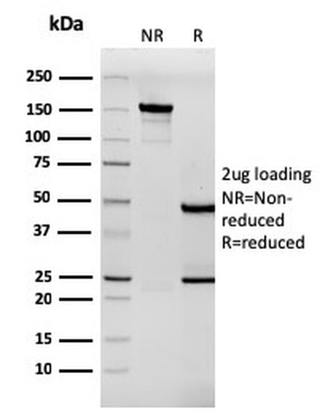 Tenascin C Antibody in SDS-PAGE (SDS-PAGE)