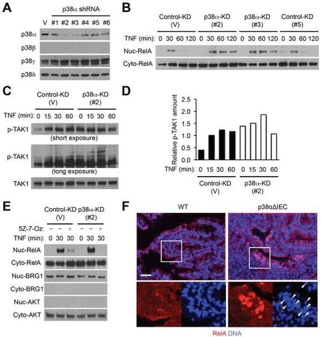 p38 MAPK beta Antibody in Western Blot (WB)