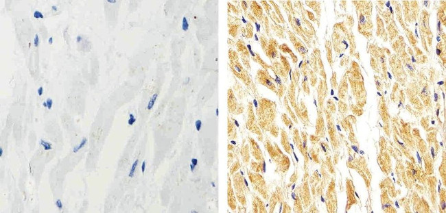 p38 MAPK beta Antibody in Immunohistochemistry (Paraffin) (IHC (P))