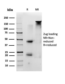 ID1 (Inhibitor of DNA-binding) (Transcription Factor) Antibody in SDS-PAGE (SDS-PAGE)