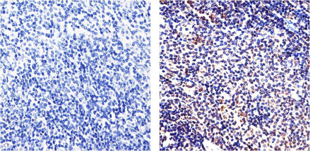 NFkB p65 Antibody in Immunohistochemistry (Paraffin) (IHC (P))