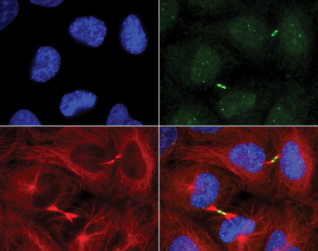 Cdc14B Antibody in Immunocytochemistry (ICC/IF)