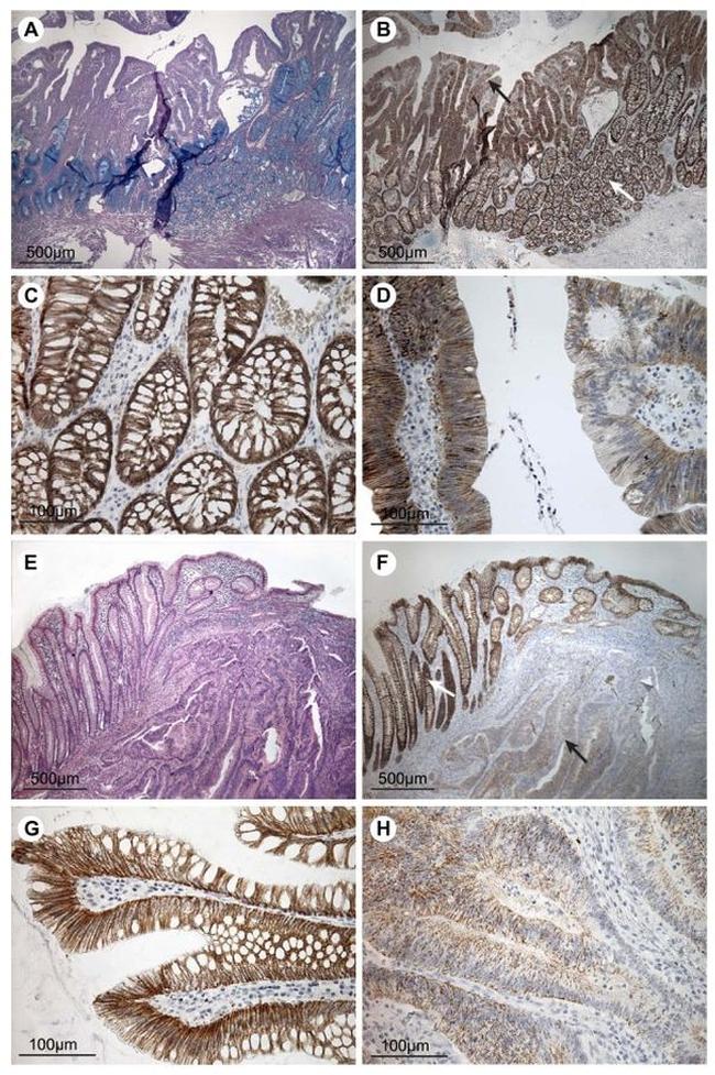 Claudin 7 Antibody in Immunohistochemistry (IHC)