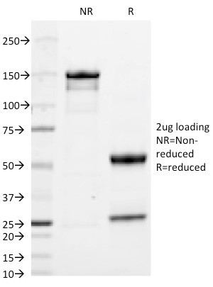 IgA (Immunoglobulin Alpha Heavy Chain) (B-Cell Marker) Antibody in SDS-PAGE (SDS-PAGE)