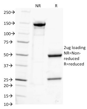 IgG (Immunoglobulin Gamma Heavy Chain) (B-Cell Marker) Antibody in SDS-PAGE (SDS-PAGE)