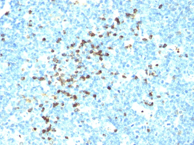 Immunoglobulin Gamma (IgG) Heavy Chain Antibody in Immunohistochemistry (Paraffin) (IHC (P))