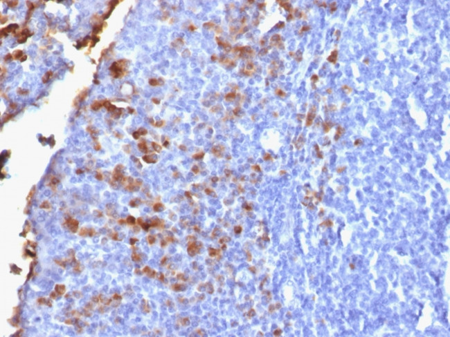 IgG (Immunoglobulin Gamma Heavy Chain) (B-Cell Marker) Antibody in Immunohistochemistry (Paraffin) (IHC (P))