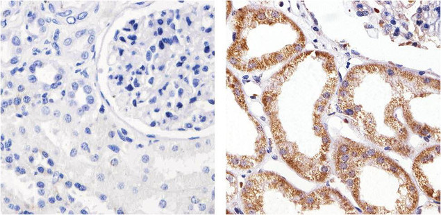 Claudin 5 Antibody in Immunohistochemistry (Paraffin) (IHC (P))