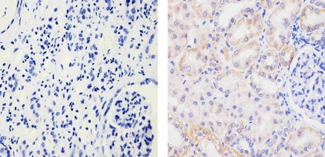 EphB4 Antibody in Immunohistochemistry (Paraffin) (IHC (P))